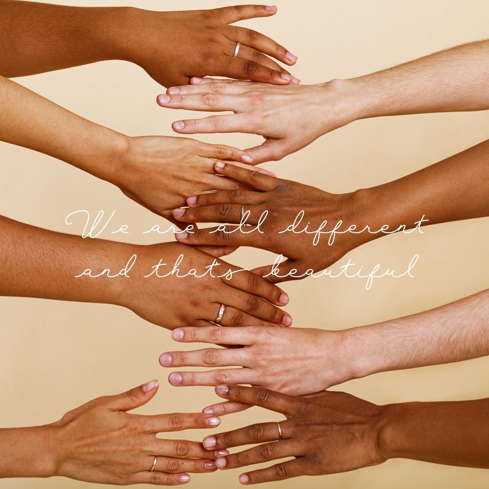 We are Different and That’s Beautiful